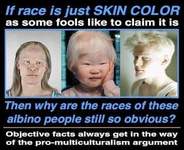 albinos races.webp